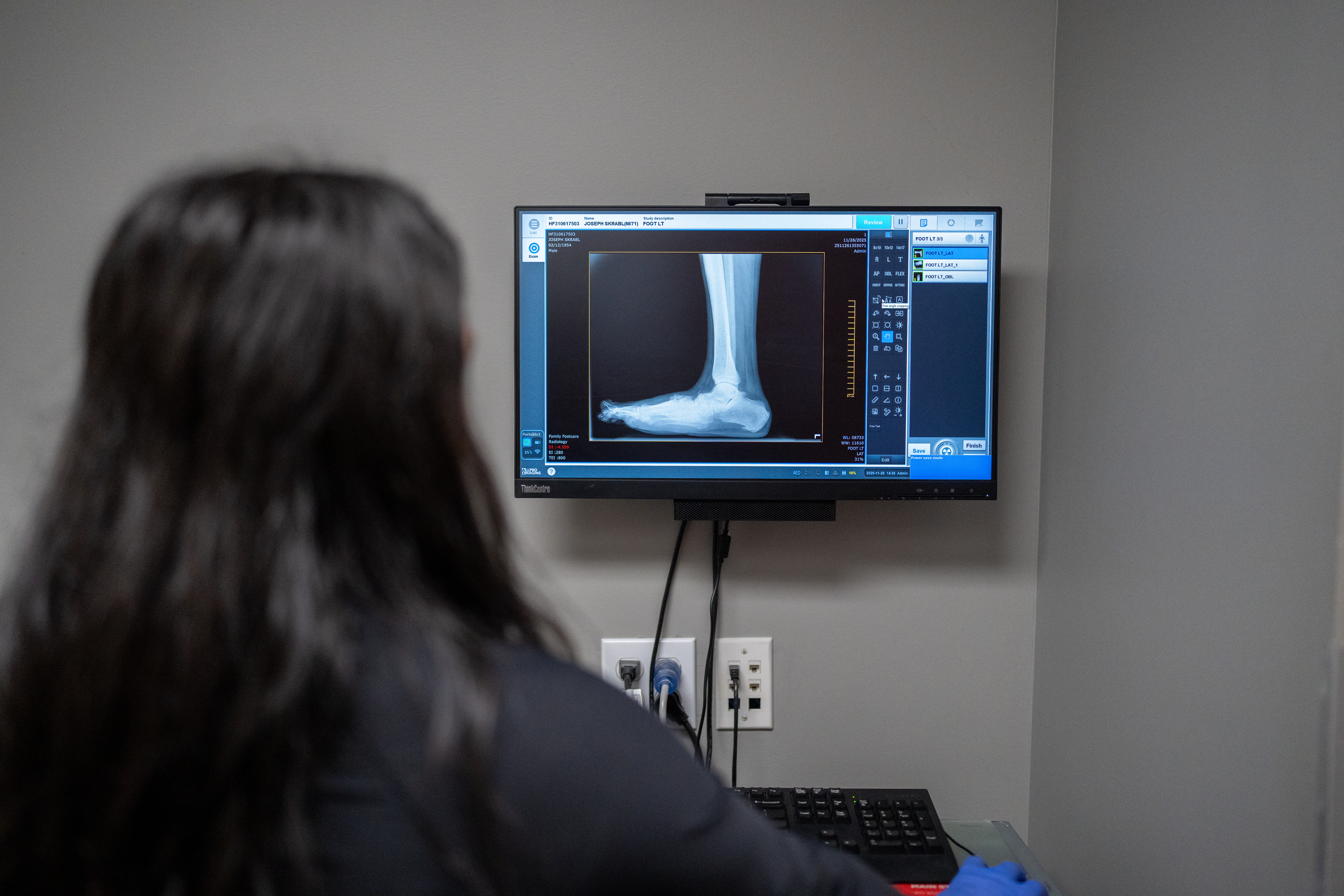 our podiatric doctor checking a ankle and foot trauma on X-ray