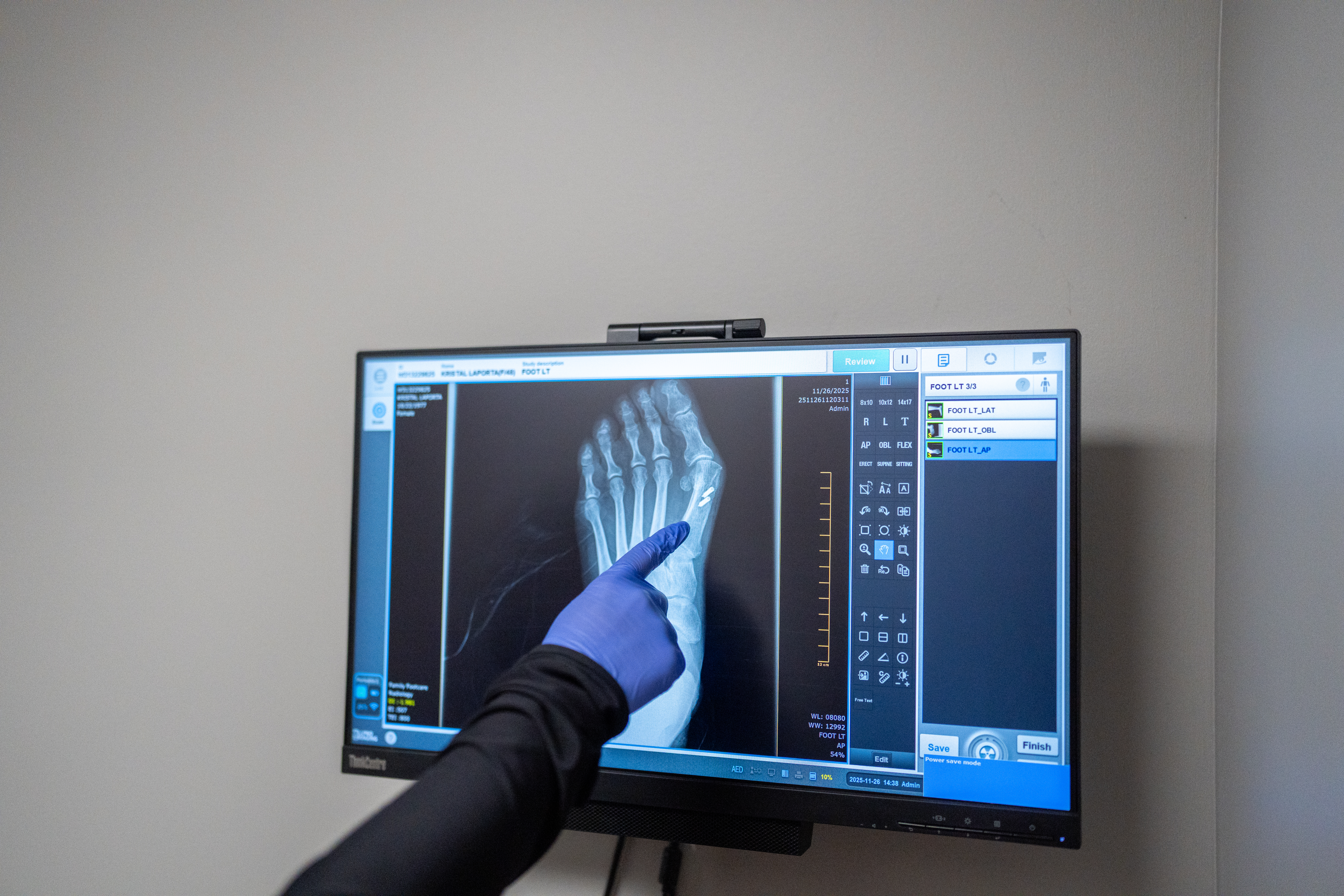 sports medicine and foot/ankle pain relief in CT